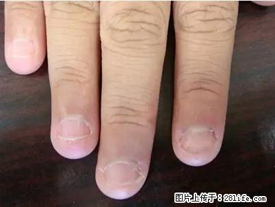 剪指甲、挖耳屎，这些日常小动作竟隐藏大危害！ - 抚顺生活资讯 - 抚顺28生活网 fushun.28life.net